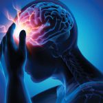 سکته مغزی | علل و علائم