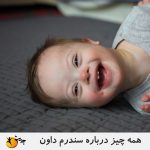 سندرم داون چیست؟