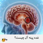 غده پینهآل یا اپی فیز