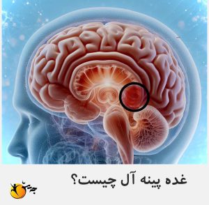 غده پینه‌آل یا اپی فیز