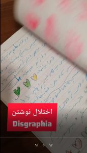 اختلال دیکته