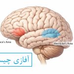 آفازی چیست؟
