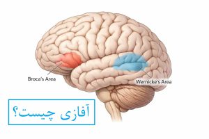 آفازی چیست؟